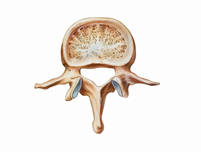 OSTEOPENIA to choroba kości. Przyczyny, objawy i leczenie osteopenii