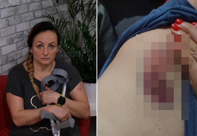Mysłowice. Pies zaatakował panią Basię