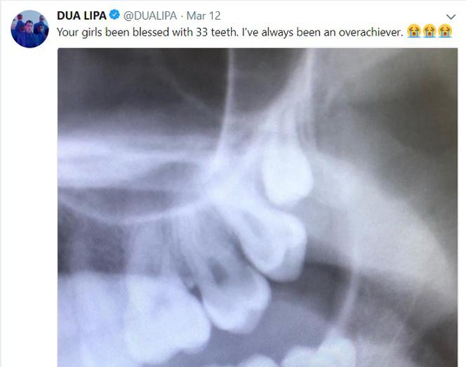 Dua Lipa ma za dużo zębów. Polscy dentyści zajęli się tym czy to wpływa na jej talent wokalny