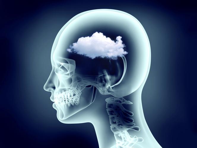 Brain Fog (mgła umysłowa, mózgowa)