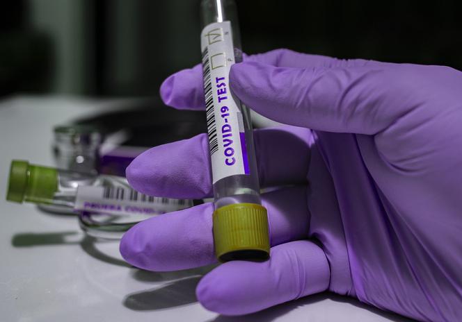 Koronawirus. Nowe zakażenia w powiecie tarnowskim i bocheńskim