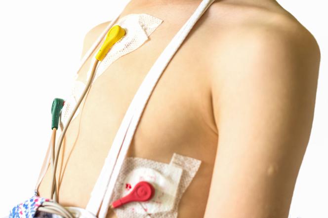 Holter - wszystko o EKG metodą Holtera