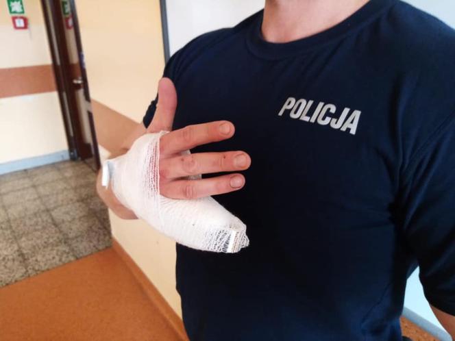 Poznań. Odgryzł palec policjantowi