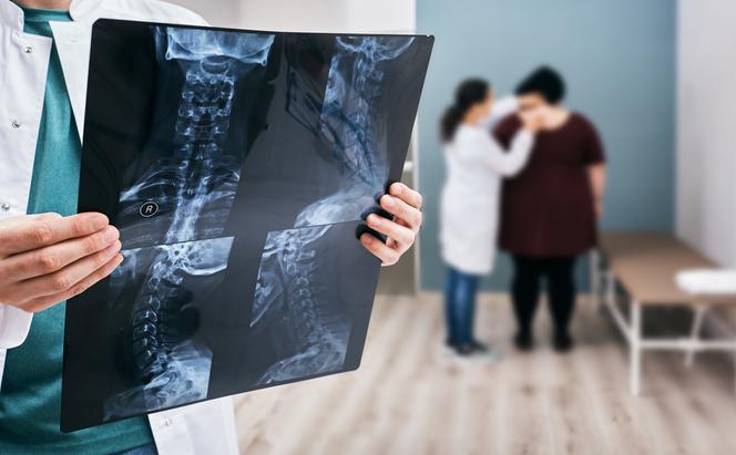 Zespół górnego otworu klatki piersiowej - czym jest i jakie są jego objawy?