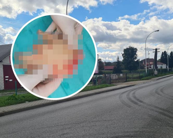 Dramat Maksa. Tasakiem odcięto mu dłoń. To były porachunki?! Drastyczne zdjęcia