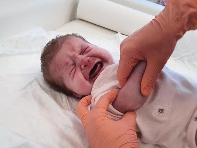 Malutka Amelka POTWORNIE cierpi! Jedynym ratunkiem jest kosztowna operacja!
