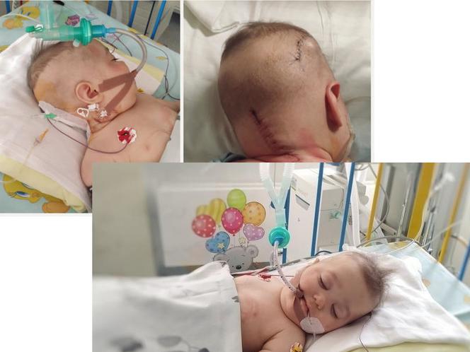 Malutki Igorek z Dębicy walczy o życie. Na zebranie pieniędzy na operacje są 2 tygodnie!
