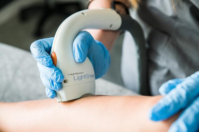 Co powinieneś wiedzieć o depilacji laserowej? Odwiedź BodyMed w Bydgoszczy!