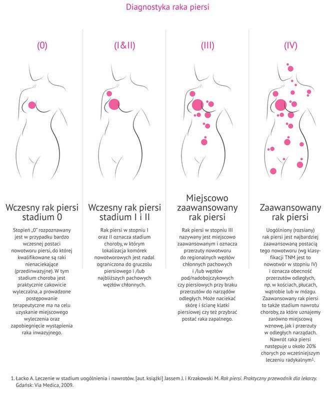Diagnostyka raka piersi - infografika