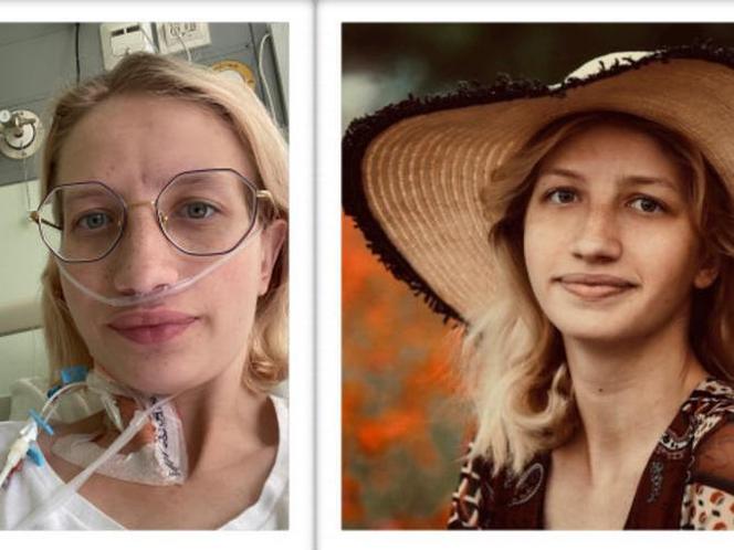 Mukowiscydoza odbiera jej oddech. Monika z Chęcin prosi o pomoc