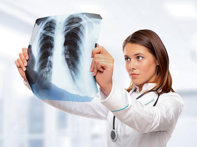 Doktor z RTG