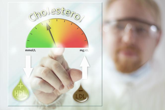 Podwyższony poziom CHOLESTEROLU nie boli, ale jest groźny