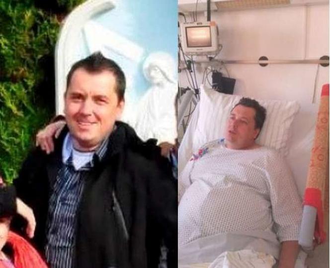 Chory na raka Juliusz Czupak