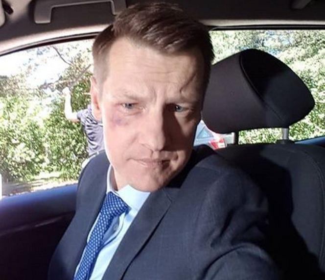 M jak miłość po wakacjach 2020. Piotrek będzie miał straszny wypadek. Pobiegnie za Kingą i będzie zwijał się z bólu! - WIDEO