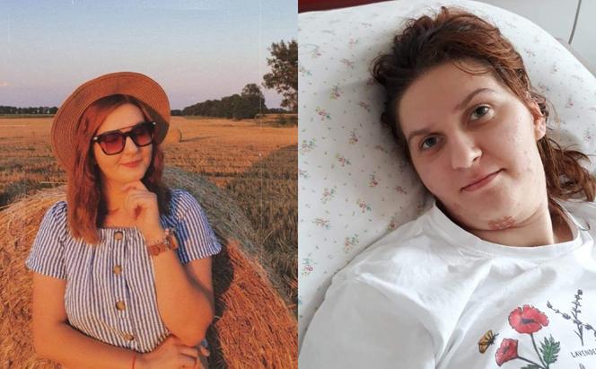 Wypadek zmienił życie 27-latki. Dwa miesiące była w śpiączce! Karina, jeszcze odrobina!
