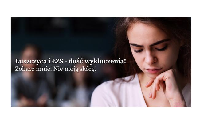 Poznaj łuszczycę