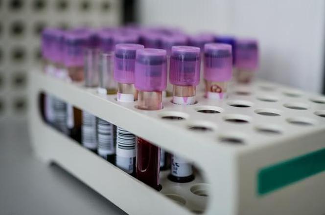 Koronawirus w Koszalinie. Kolejki do punktów pobrań. Na testy trzeba długo czekać!