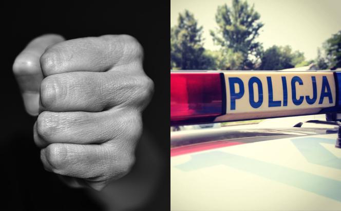 Pobicie obcokrajowca we Wronkach. 28-latek wylądował w szpitalu!