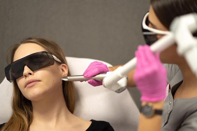 Jak pozbyć się krępujących przebarwień i pajączków na skórze? Pomoże Ci w tym bydgoski Laser DeLux!