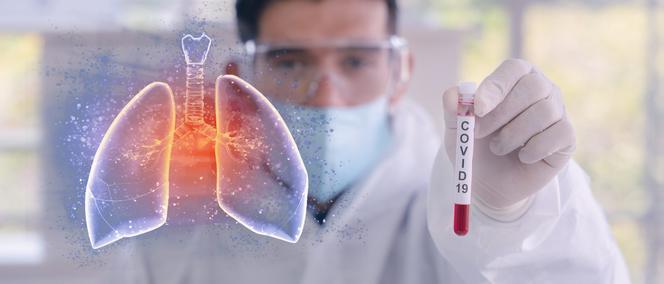 Koronawirus: epidemia w Polsce