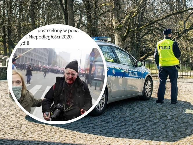 SKANDAL na Marszu Niepodległości 2020. Tomasz Gutry, legendarny fotoreporter, postrzelony przez policję?