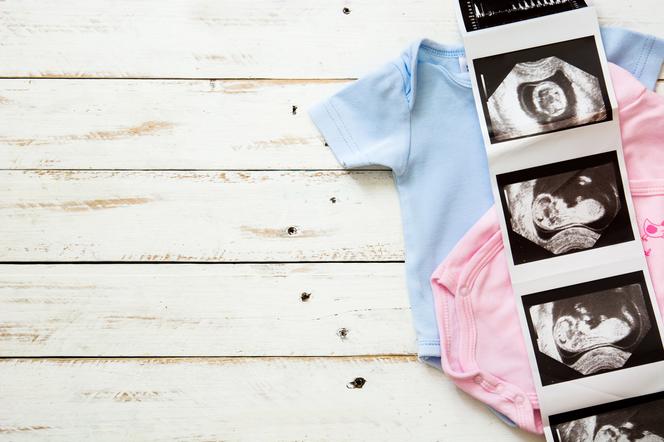 Pomyłki na USG w płci dziecka - skąd się biorą pomyłki lekarza?
