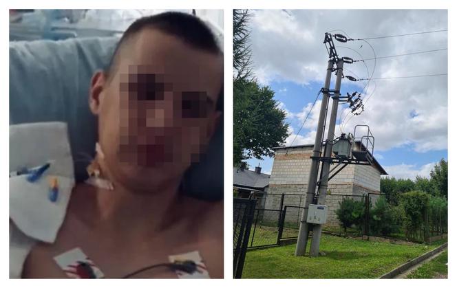14-latek wspiął się na słup, obrażenia są ogromne. Wszystko przez Tik-Toka?! Przyszły strażak walczy o życie!