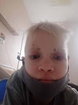 Lekarze podnieśli mu powieki