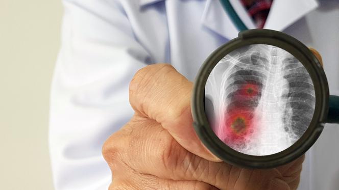 Koronawirus: epidemia w Polsce