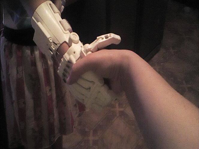 Na jednej drukarce 3D taka proteza powstaje w około 10 godzin