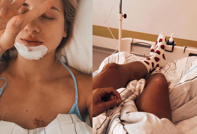 Narciarstwo biegowe, biegi narciarskie, Izabela Marcisz, uraz, szpital, kontuzja