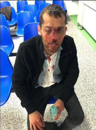 Brutalny atak na Żydów w centrum Warszawy