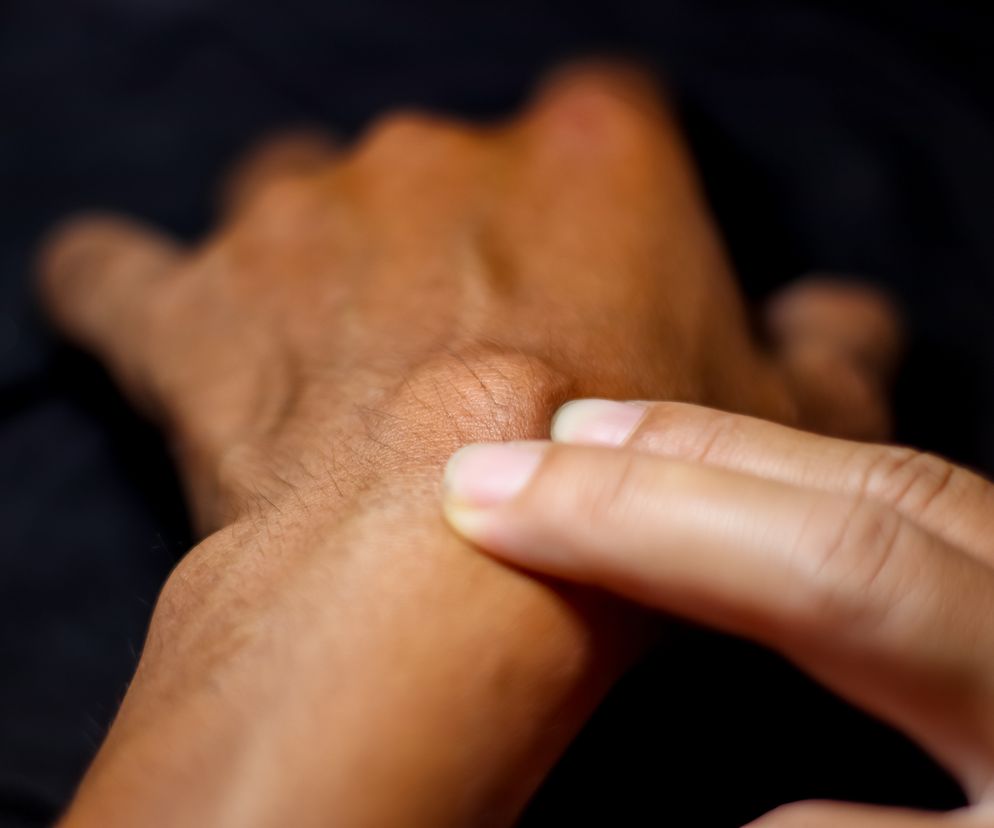 zbliżenie na cystę, czyli torbiel