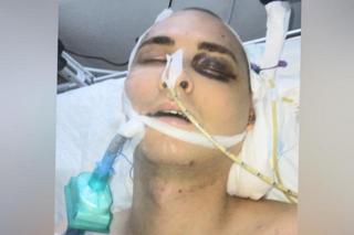 Mateusz z Raczek przeżył wypadek samochodowy. Czeka go długotrwałą rehabilitacja. Mama 22-latka: Z całego serca proszę o pomoc!