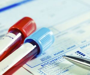 Przeciwciała anty-TPO - norma. Jak interpretować wyniki badań?