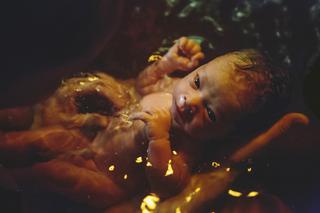 ŁOŻYSKO po PORODZIE: kobiety ZJADAJĄ łożyska po porodzie, bo pomagają im zwalczyć BABY BLUES?
