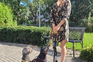 Marlena zbiera na nową protezę