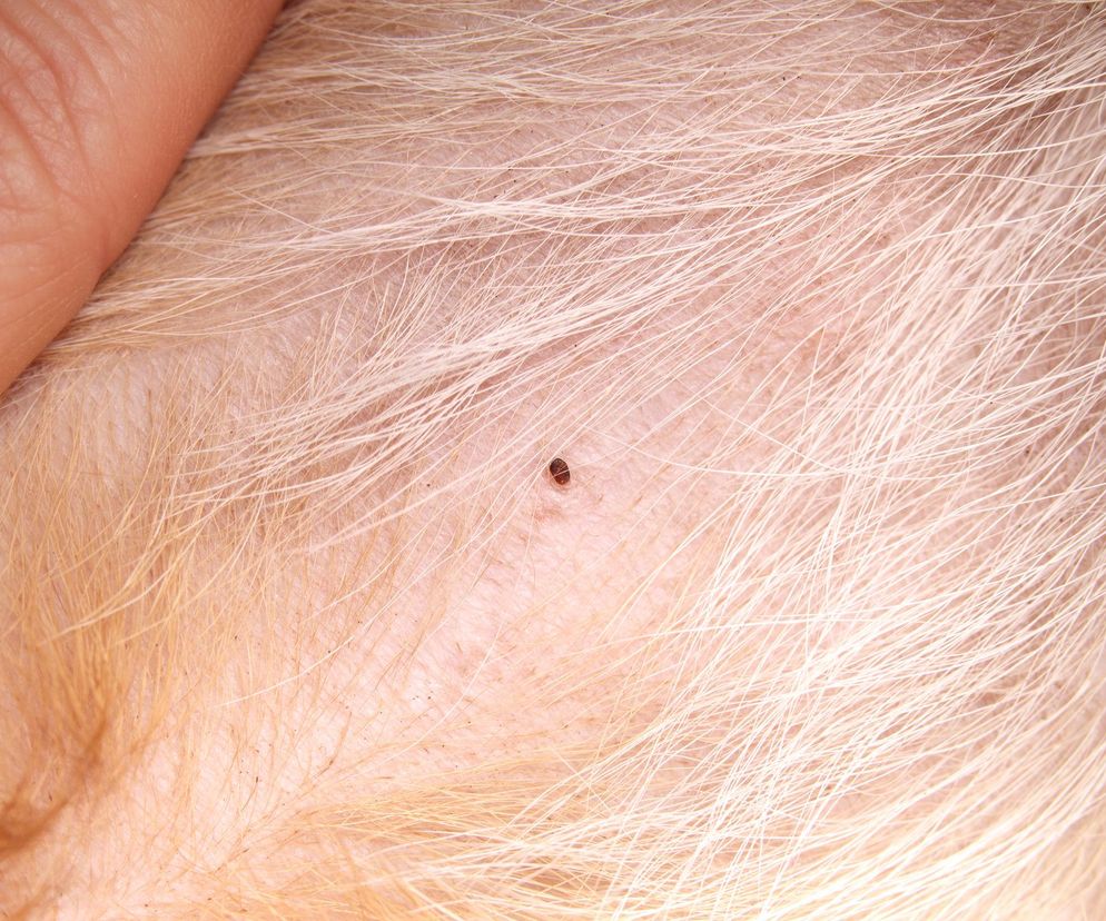 Niewidoczne zagrożenie, poważne konsekwencje. Mało kto wie, że to nie pieprzyk, ale pajęczak