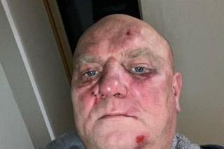  Bandyci bili i torturowali biznesmena. 