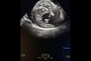 Sercowe problemy Czarnego [GALERIA]