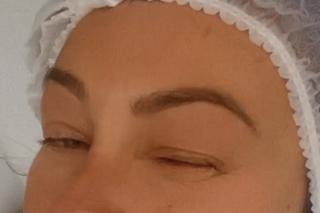 Monika Jarosińska przeszła operację by lepiej widzieć