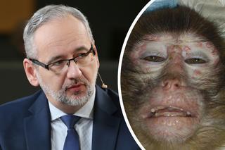 Stało się! Pierwszy przypadek małpiej ospy w Polsce! Minister Niedzielski potwierdził
