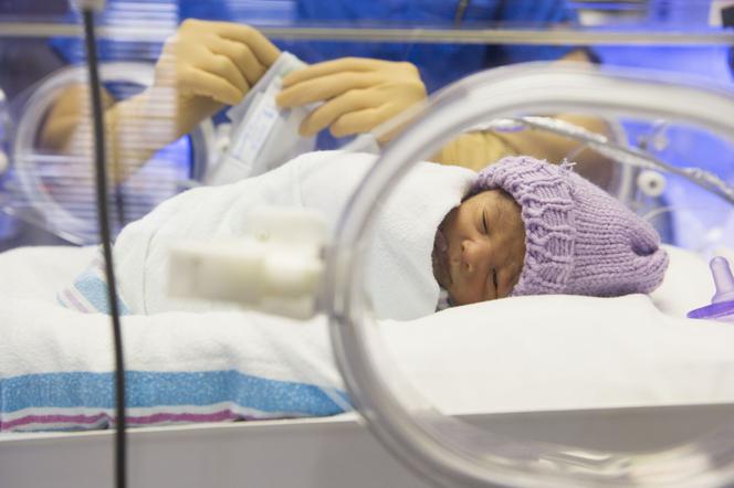 Żółtaczka fizjologiczna u noworodków – czy powinnaś się jej bać
