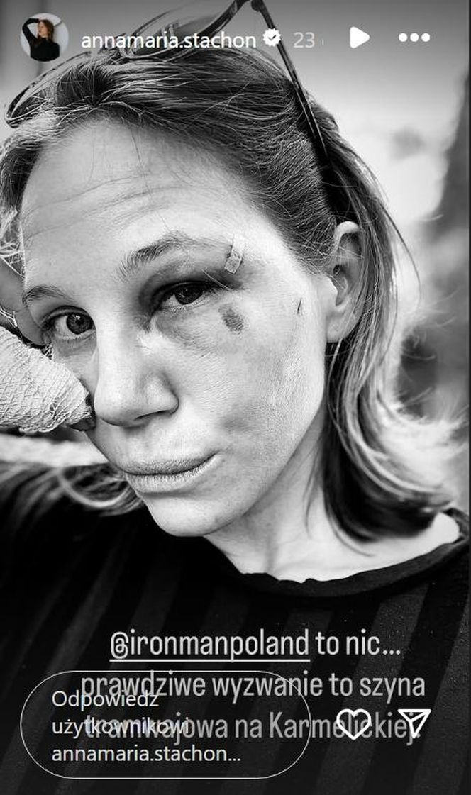 Córka Ryśka z Klanu miała poważny wypadek! Wstrząsające zdjęcia!