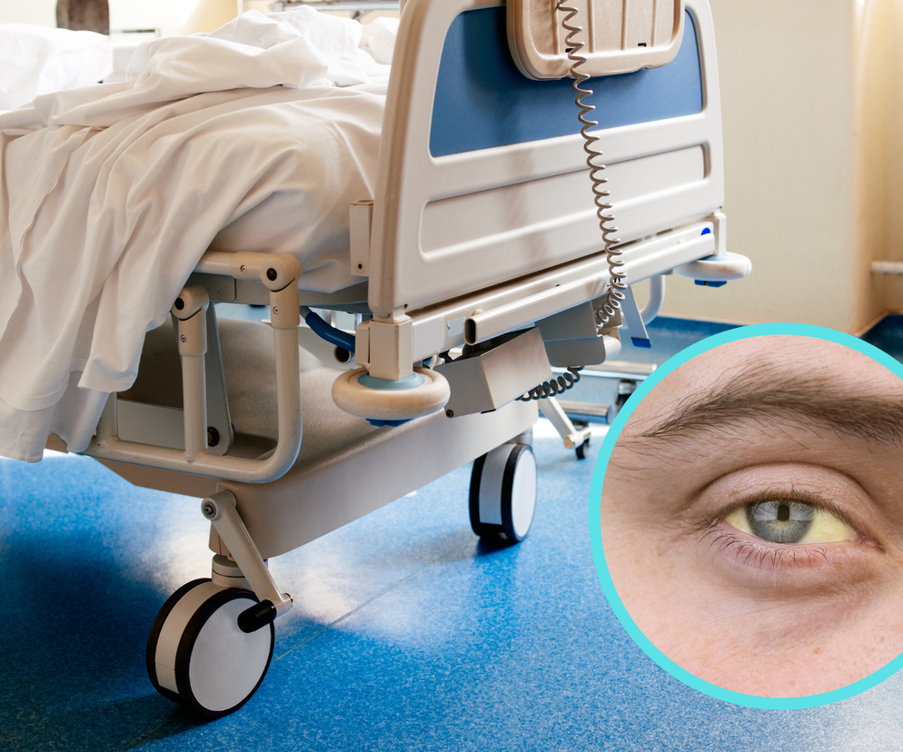 Żółte oczy i ból brzucha były objawem raka. Tych wczesnych oznak nie należy lekceważyć