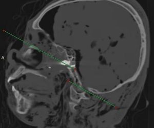 Ujawnił prawdę o sztucznej inteligencji. Znaleziono go martwego