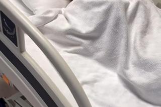 Ma największe policzki na świecie! I tak są za małe. Pokazała jak wyglądała kiedyś!