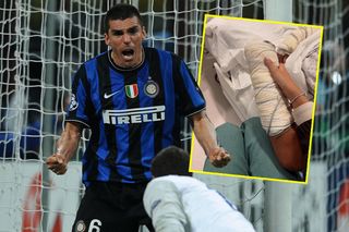 Cały kraj przeżywał jego traumę. Jego ciało pokryły oparzenia, teraz mówi o tym otwarcie