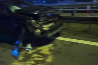 Uwielbiany muzyk uległ wypadkowi. Pokazał zdjęcia! Koncert odwołano