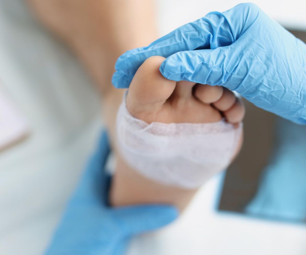 Zakażenie rany – objawy. Jak rozpoznać zakażenie rany?